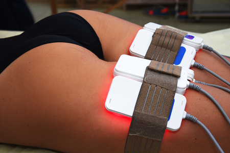 Laser Lipo at Sculpt