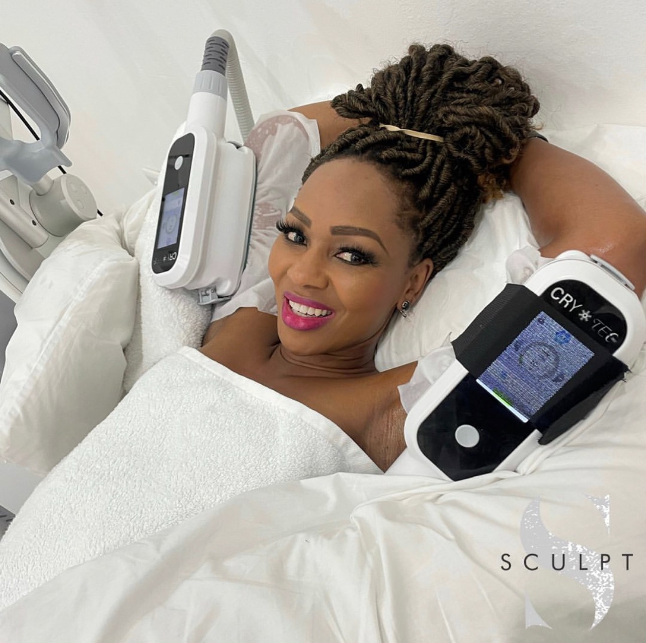 A real Sculpt fat-freezing client